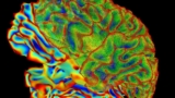 Brain_NIH.jpeg