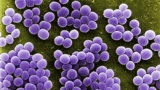 A scanning electron microscopic (SEM) image shows a strain of Staphylococcus aureus bacteria, the focus of LimmaTech AG from Switzerland, now being acquired by Eli Lilly