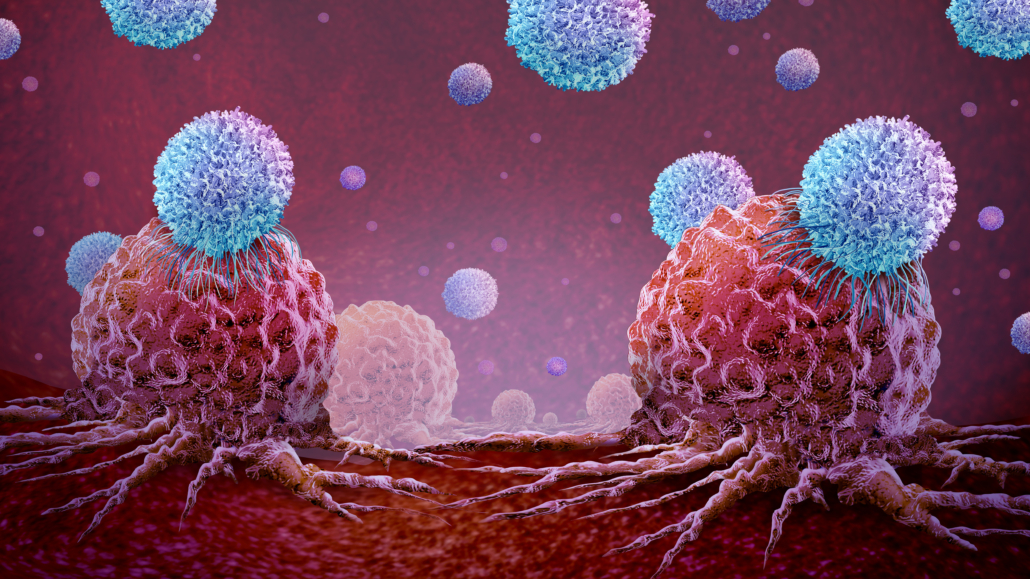 Immune Cancer Therapy or immunology treatment and oncology symbol as Malignant Cancerous Growth and Metastasis anatomy concept as growing tumor cells and CAR T Cell