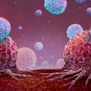 Immune Cancer Therapy or immunology treatment and oncology symbol as Malignant Cancerous Growth and Metastasis anatomy concept as growing tumor cells and CAR T Cell