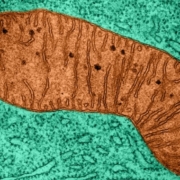 MitoRx Therapeutics targets mitochondrial to treat obesity