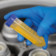 ELAREM®: Human Platelet Lysate