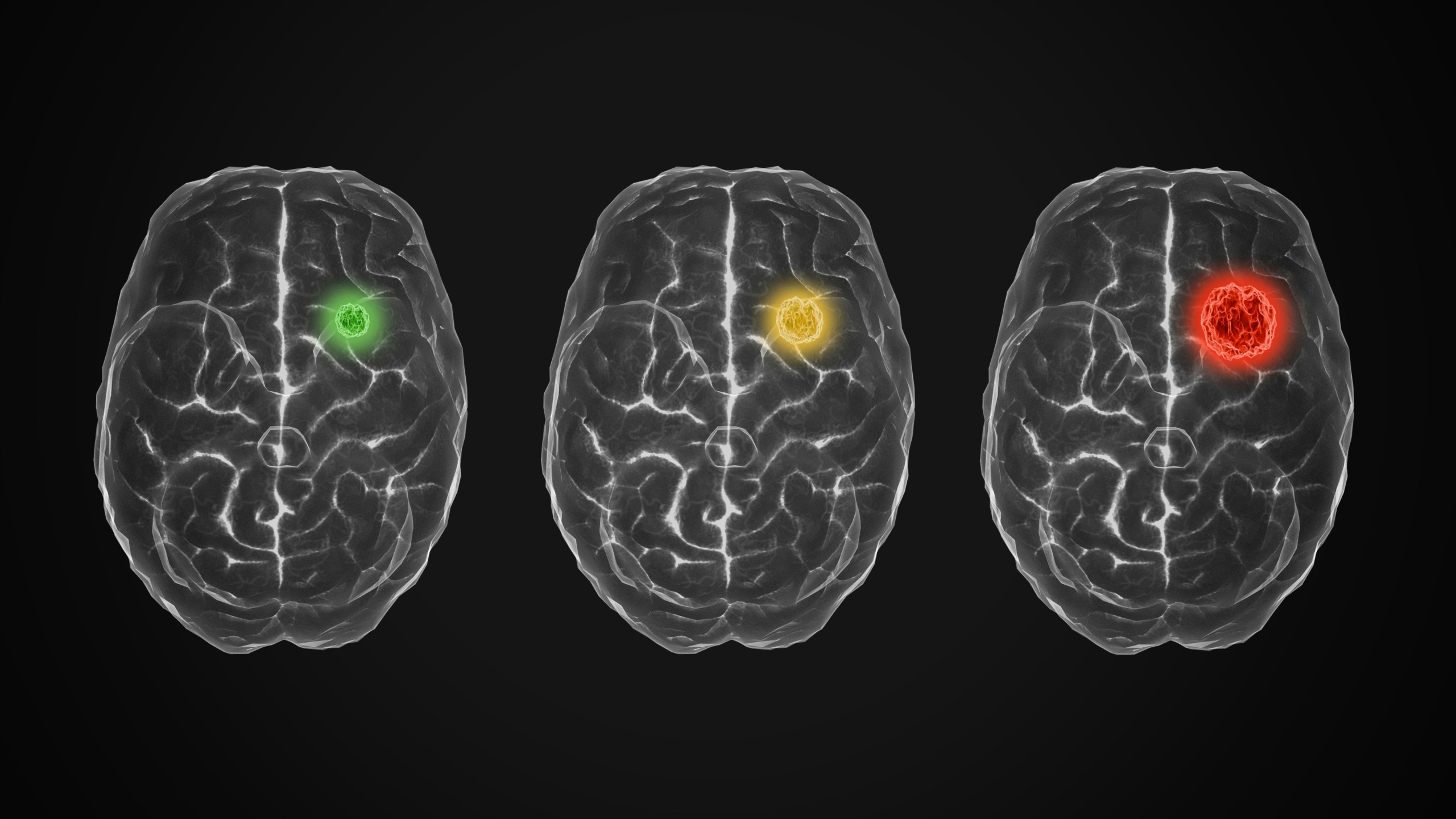 Biotech Beactica and research institute LISCO secured €2.5M to advance glioblastoma therapy to the clinic