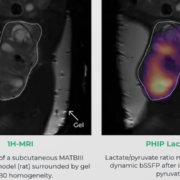Comparison MRI and NVision polarized hydrogen application