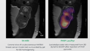 Comparison MRI and NVision polarized hydrogen application