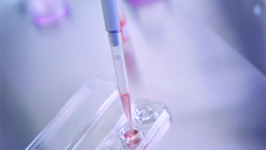 Doctor transferring liquid into a cell dish with precision