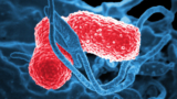 Multi-drug resistant Klebsiella pneumoniae bacteria can cause severe hospital-acquired infections.