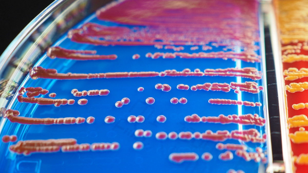 Astorg spins off Thermo Fisher’s microbiology arm