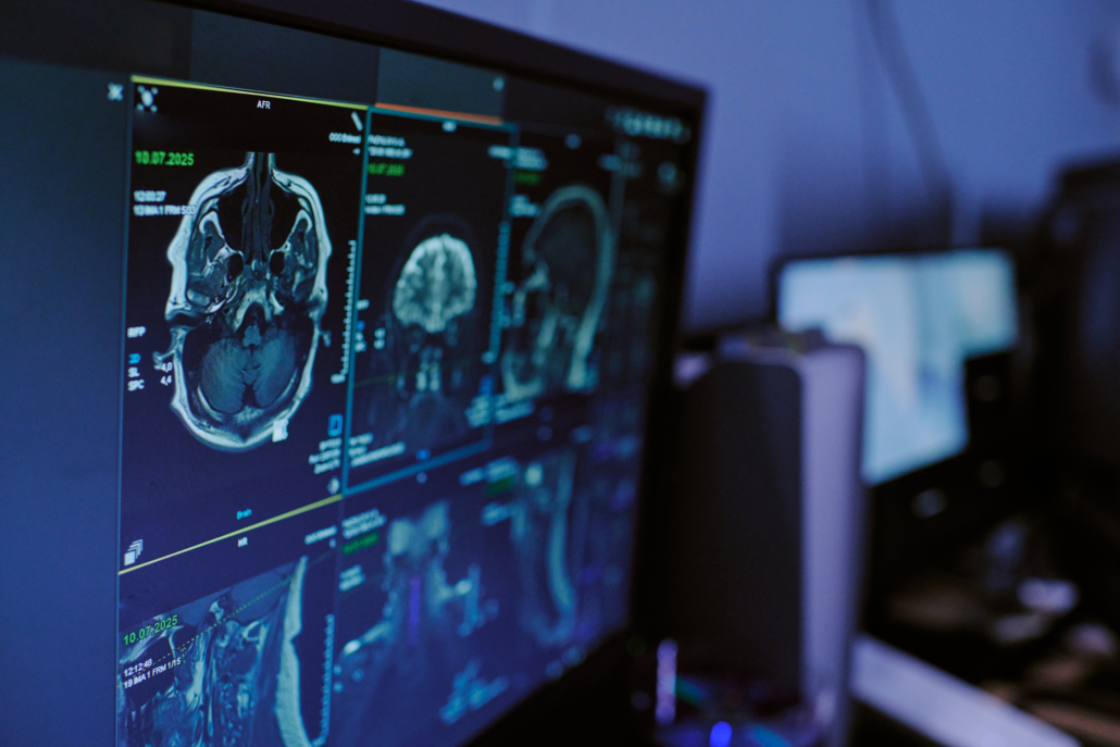 Brain Mri Scans Displaying on Medical Monitor in Hospital Diagnostic Setting