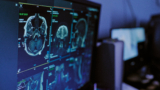 Brain Mri Scans Displaying on Medical Monitor in Hospital Diagnostic Setting