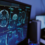 Brain Mri Scans Displaying on Medical Monitor in Hospital Diagnostic Setting