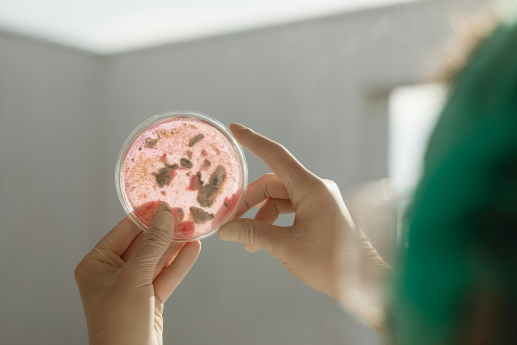 bacteria petri dish