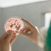 bacteria petri dish