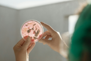 bacteria petri dish