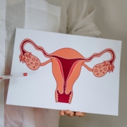 ovarian cancer