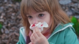 Different symptoms come with Hereditary Hemorrhagic Telangiectasia: chronic nose bleeding (epistaxis) shows up in 90% of patients, but Internal arteriovenous malformation (AVM) in other organs like brain or liver are source of severe issues like stroke, hypertension and heart illness.