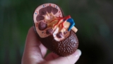 kidney disease