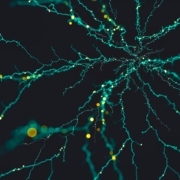 network brain cells neurons