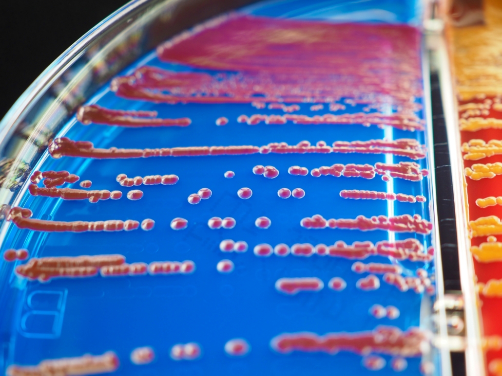 bacteria on agar medium bacteria on agar medium