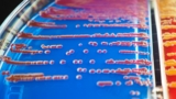 bacteria on agar medium