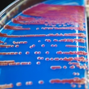 bacteria on agar medium