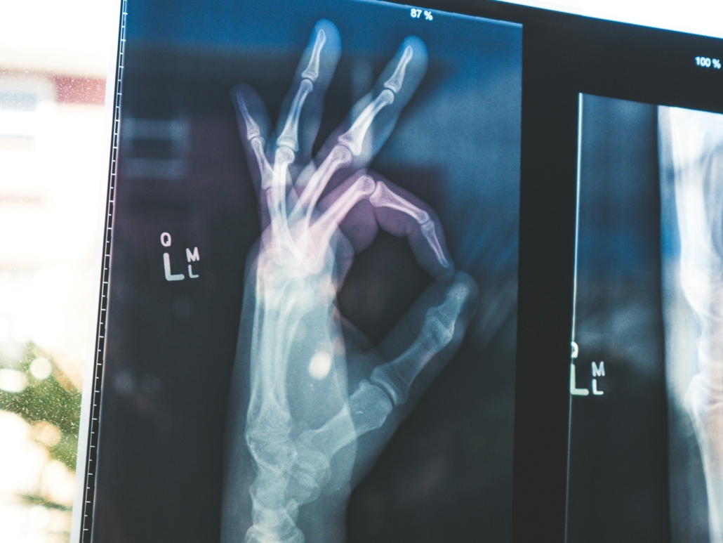 radiology hand sign