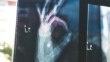 radiology hand sign