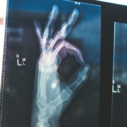 radiology hand sign