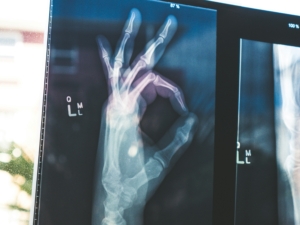radiology hand sign